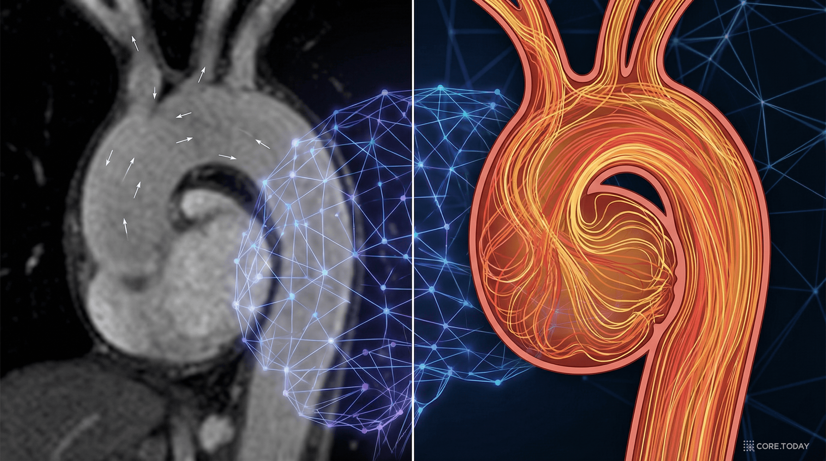 MRI와 PINN으로 비침습적 혈류 분석
